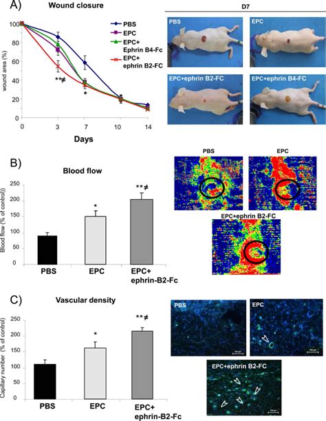 Eph B Fc Increases Epc Proangiogenic Potential In Wound Healing Days