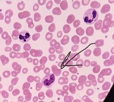 Wbc Morphology Exercise With Anomalies Flashcards Quizlet