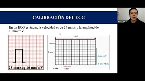 2 y 3 PAPEL DEL ELECTROCARDIOGRAMA Y LA CALIBRACIÓN DR PABLO FRUTOS