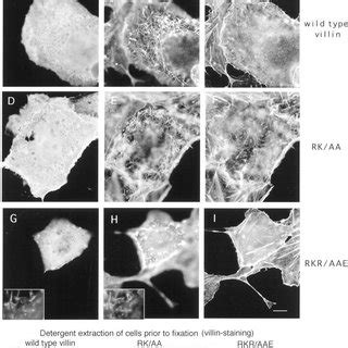 F Actin Bundling By Villin And Villin Variants Electron Micrographic