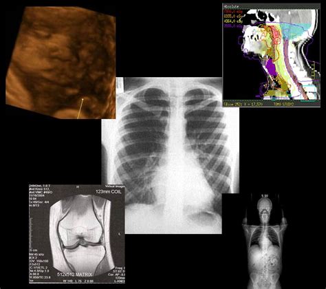 Medical Imaging And Radiation Sciences
