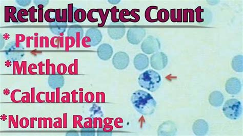 Reticulocyte Count Staining Principle Method Calculation Normal