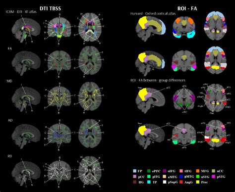 Between Group Differences In Dti Parameters And Roi Fa Values Left