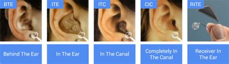 Hearing Aid Diagram - Preston Hearing Centre