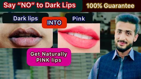 Dark Lips Treatment Get Rid Of Of Dark Lips Lips Care 👄 Get