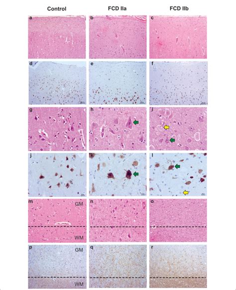 FIGURE Representative Histopathological And Immunostaining Features Of