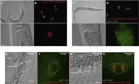 Coelomocytes Regulate Starvation Induced Fat Catabolism And Lifespan