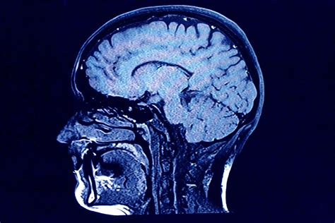 Understanding The Default Mode Network