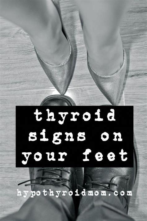 10 Signs Your Feet Are Warning You About A Thyroid Problem Artofit