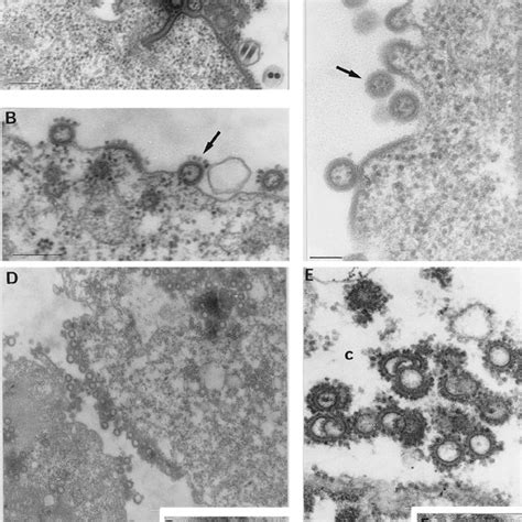 Thin Section Electron Microscopy Of Sf9 Cells Infected For 48 H A