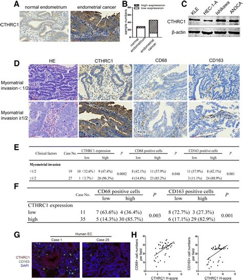 Cthrc Is Highly Expressed In Ec And Positively Correlated With