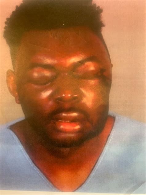 La Deputies Accused Of Beating Man Until He Lost Sight In One Eye