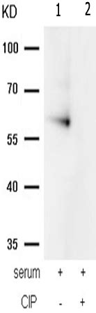 兔抗PRKAA1 PRKAA2phospho Thr183 Thr172多克隆抗体 Anti PRKAA1 PRKAA2 phospho