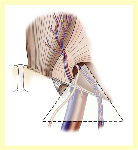 Hernia Symptoms Male Groin : Laparoscopic inguinal hernia surgery India ...