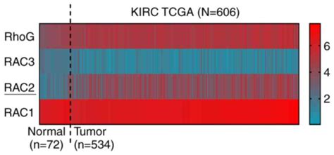 RAC2 Acts As A Prognostic Biomarker And Promotes The Progression Of