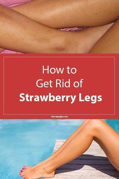 How To Get Rid Of Strawberry Legs Shareit Strawberry Legs Dark Pores Exfoliate Legs