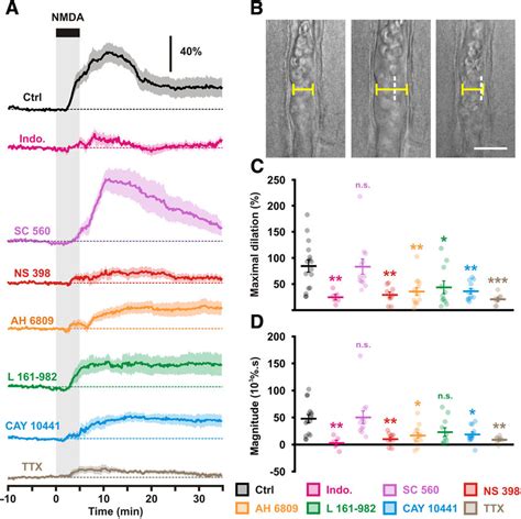 Characterization Of Nmda Induced Vasodilations A Diameter Changes