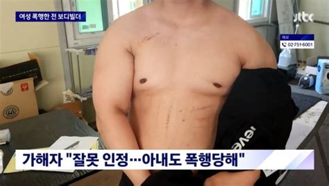 전직 보디빌더 “차 빼달라” 요구한 여성 무차별 폭행 국민일보