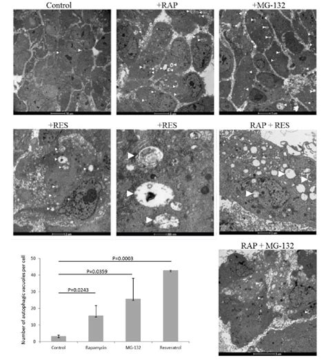 Arpe Cell Treated By Autophagy Inducer Rapamycin Rap Nm