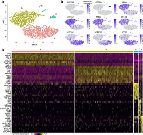 A Single Nuclei Rnaseq Of The Human Skeletal Muscle Slow Type I And