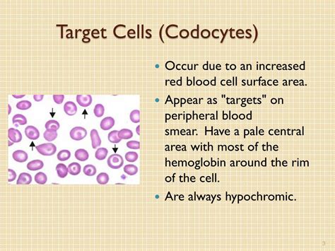 PPT MLAB 1415 Hematology Keri Brophy M Artinez PowerPoint