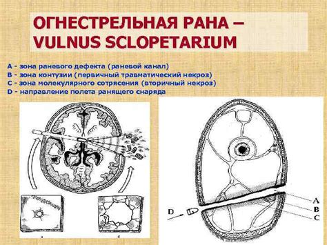 Раны Классификация ран Клиническая картина Фазы раневого процесса