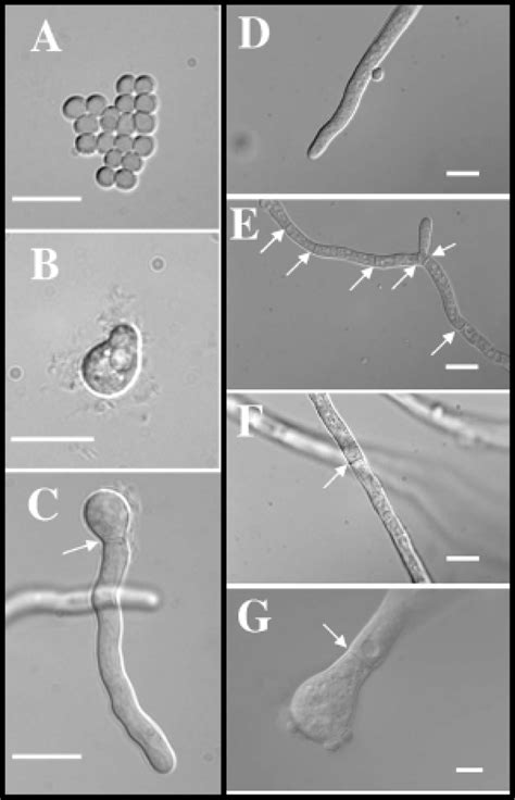 2. Growth and germination of A. fumigatus. (A) Dormant conidia (0 hrs ... 