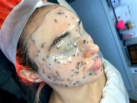 Frosty Facial The Flawless Lab Scottsdale Arizona