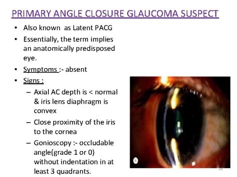 Primary Angle Closure Glaucoma Dr Ajai Agrawal Additional