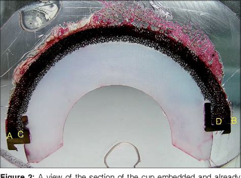 Figure 1 From Analysis Of Bone Ingrowth On A Tantalum Cup Semantic