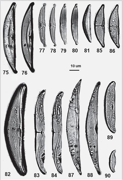 Marine Benthic Diatoms In Coral Reefs Off Basra Figs 75 76 Amphora