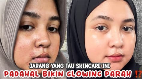 Cara Membuat Skincare Alami Untuk Memutihkan Wajah Kusam Dan Kering