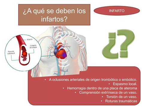 Cap Tulo Transtornos Hemodin Micos Enfermedad Tromboemb Lica Y Shock