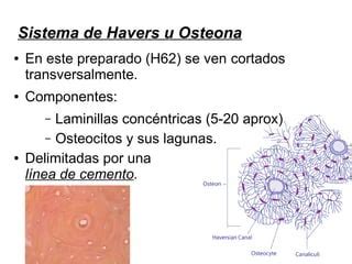 Practico 6 tejido óseo y epiglotis PPT