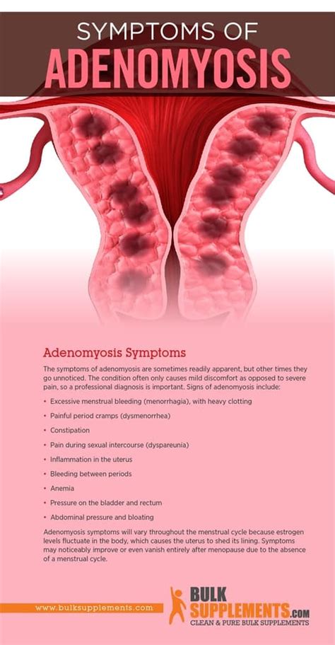 What Is Adenomyosis Causes Symptoms Treatment