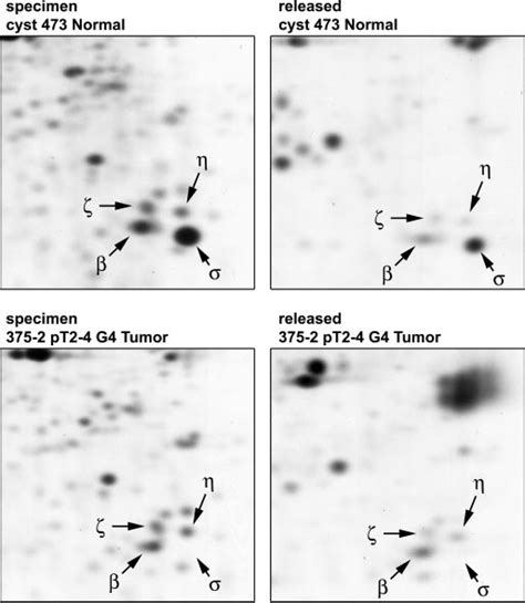 Proteomic Analysis Of Externalized Proteins 35 S Methionine Labeled