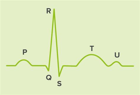 Cómo interpretar el ECG MESI Simplifying Diagnostics