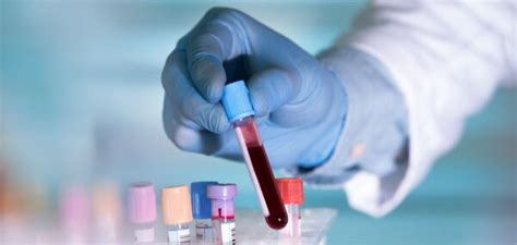 A blood test for Alzheimer's condition | Happiest Health