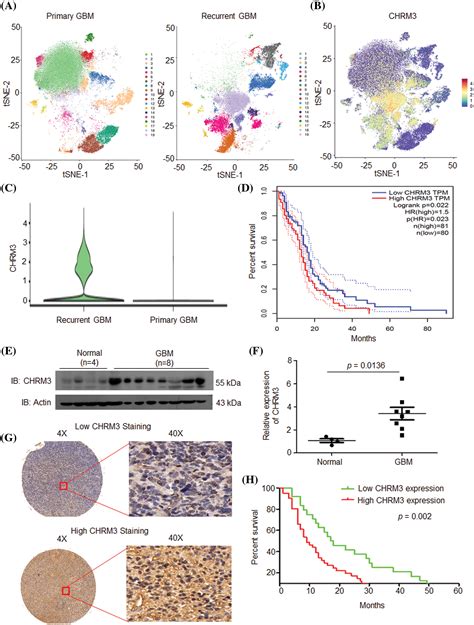 Or Free Full Text Chrm Is A Novel Prognostic Factor Of Poor