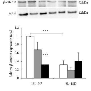 a Representative Western blot analysis of N cadherin β catenin and