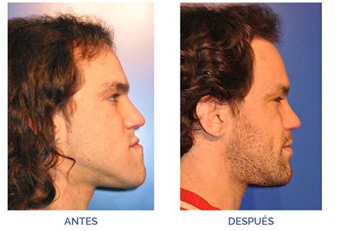 Ivan Icomf Cirug A Oral Y Maxilofacial