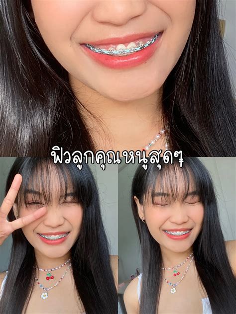 สียางจัดฟันฟันขาวเชน การค้นหาใน Lemon8