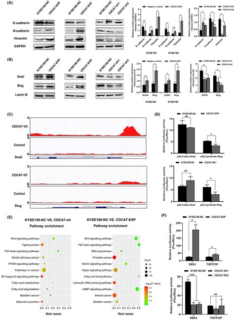 Cdca7 Promotes Tgf‐β‐induced Epithelialmesenchymal Transition Via