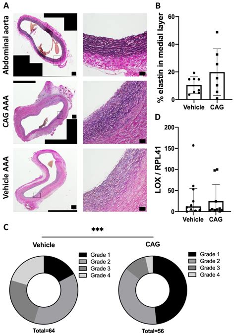 Elastin Assessment In Abdominal Aortic Aneurysms Aaa A