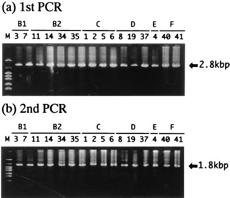 Electrophoresis Of PCR Amplified Products Agarose Gel Electro