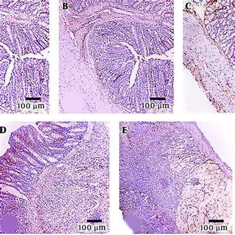 Show Normal Histological Layers Of Human Colon Consist Of Mucosa Lined Download Scientific