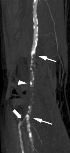 Peripheral Arterial Occlusive Disease Diagnostic Performance And