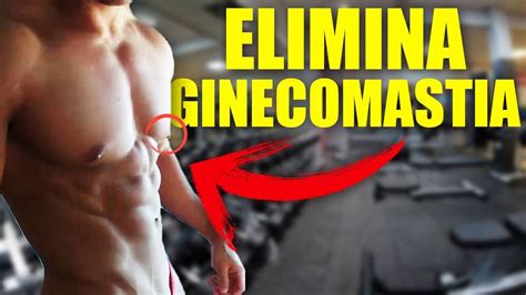 Como Corregir La Ginecomastia En Hombres Causas Y Tratamiento Youtube