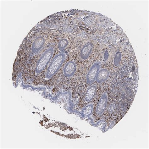 Tissue Expression Of ODC1 Staining In Appendix The Human Protein Atlas