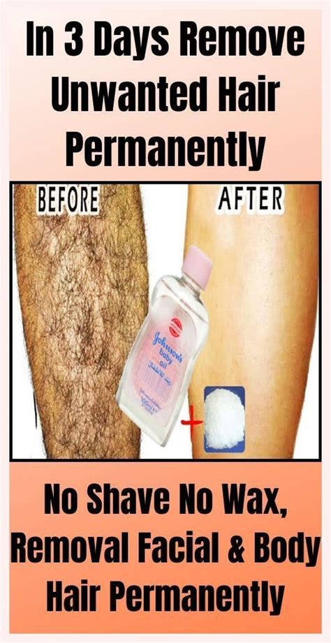 Remove Unwanted Hair Permanently Artofit